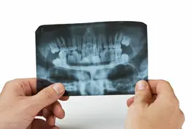 骨折后钢板一定要取？取出的钢板，能带回家吗？医生统一回复了图片