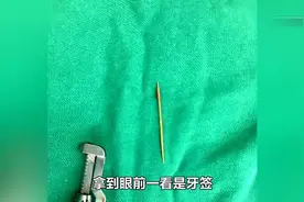 真的扎心！陕西女子持续两个月发烧，竟是心脏上扎了根牙签！