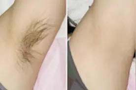 脱毛膏不用买啦，美女教你自制脱毛神器，几毛钱轻松脱毛不反弹视频封面