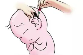 崔玉涛谈护理读懂宝宝的摇头抓耳，科学清理耳垢图片