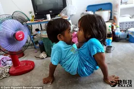 7岁连体姐妹共用一双腿 还会骑三轮车图片