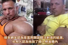 10大假肌肉，手臂大过头，毫无美感，极不自然，不计后果求速成？视频封面