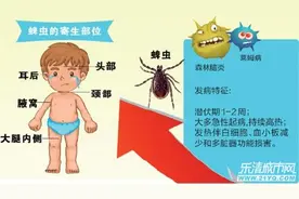 男孩头上有个会动的疙瘩 原来是蜱虫钻入头皮图片