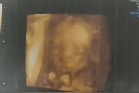 想快速通过四维原来有窍门！这样宝宝才听话图片