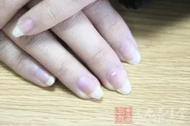 指甲上棱线透露身体健康状况图片