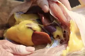 杀鸡时：发现鸡肚里有很大一块黄油，是扔掉还是吃掉？看完涨知识图片