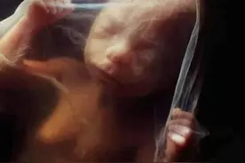 宝宝在妈妈肚子里是什么样？20张胎儿发育高清图，满足孕妈好奇心图片