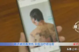 滚烫的沥青从头浇下，男子全身多处遭遇严重烧烫伤图片