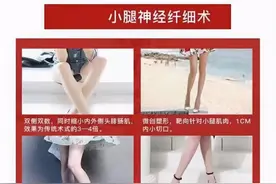 小腿神经阻断术”网络流行，神经科医生：不可逆，会出现肌肉萎缩图片