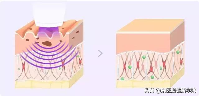 胶原蛋白粉是什么做的 2026年胶原蛋白粉是干什么用的 胶原蛋白粉是什么做的 2026年胶原蛋白粉是干什么用的
