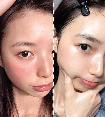 “宝藏女孩”赵露思直播卸妆，看到真实皮肤状态，网友：别化妆了