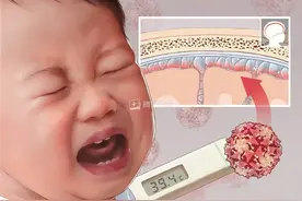 孩子高烧40℃，会不会烧坏脑子?图片