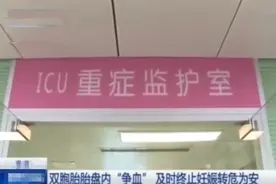 天生冤家！孕妈肚子中，双胞胎妹妹被姐姐强行吸血，医生巧妙劝和图片