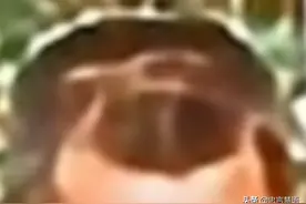 威威头上的伤疤，是妈妈心里永远的痛图片