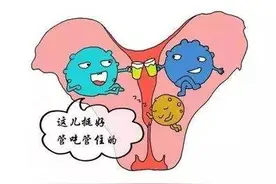 得了子宫肌瘤就要开刀？有些肌瘤保守效果更好哦！图片