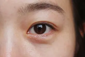身体缺乏维生素，会有哪些表现？图片