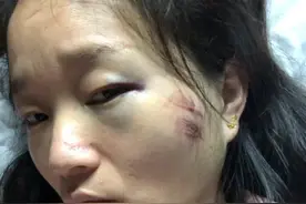 嫁给一个傻子男人是一件多么痛苦的事情图片