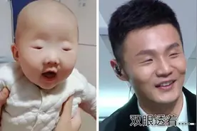 “最小眼睛宝宝”火了，医生表示孩子健康，网友：李荣浩输得不冤图片