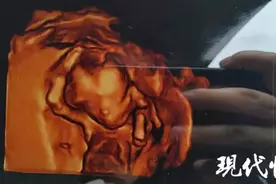 拍“胎儿写真”可预知男女？记者暗访发现…存在健康风险！！图片