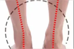 腿型不直，不能单纯考虑腿的原因，更多需要整体考虑图片