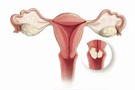 宫颈癌一般能活多少年？两极分化的答案，让人不禁感叹图片