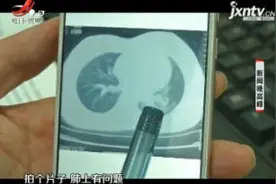 西安：12岁女孩常喝山间溪水 患上肺吸虫病视频封面