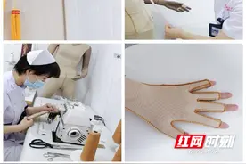 常德市第一人民医院开展压力衣制作技术防治瘢痕增生图片