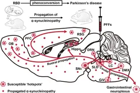 夜间睡眠为何出现争吵、尖叫等异常行为？复旦上医团队成功构建帕金森病快动眼睡眠期行为障碍动物模型图片