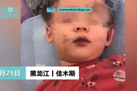 男孩吃蛋糕后嘴巴被染黑，姥爷怀疑蛋糕色素超标：洗了两天才洗掉图片