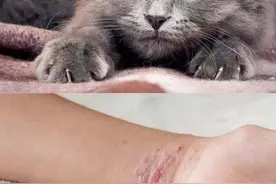 ​养猫一族注意了！猫咪带菌会感染人，这种病全球每年发病人数超过4万例图片