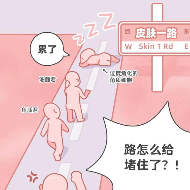 角化异常吗