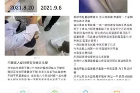 花费近两万给婴儿戴石膏头模矫正头型？更需要“矫正”的是育儿观图片