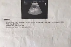 身体不痛不痒，却查出肾囊肿？3种特征的肾囊肿很危险图片