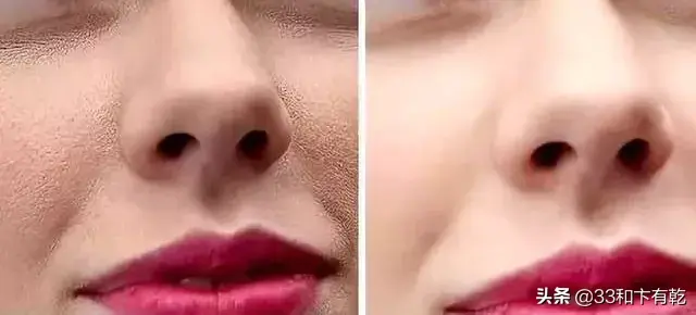 火爆INS的芝士皂，洗脸就像敷面膜，痘痘，黑头，螨虫全都消失了