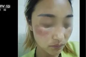 遭家暴、被前夫泼油纵火 无法逃离的网红拉姆究竟经历了什么？图片