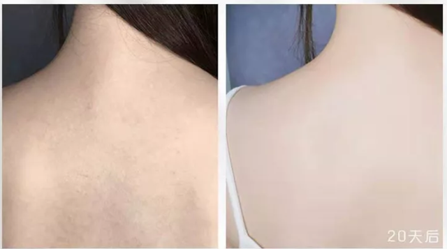 小黑裙身体乳长期涂抹能美白吗