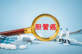 什么是胆管癌？该如何预防？医生来给你科普图片