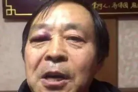 嘲讽张伟丽的太极掌门咋样了？比赛4秒被KO，倒地后无法起身图片