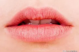 嘴唇的这6种颜色要警惕，是你的身体在报警图片