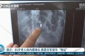 宿迁85岁老人体内留有子弹头80年 系日军侵华“物证”图片