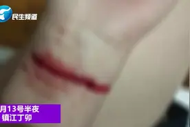 镇江：半夜，她在朋友圈发了一张血淋淋的照片视频封面