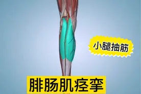 腓肠肌痉挛解剖分析，各种原因引起小腿抽筋。