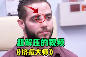 小伙鼻子上长了个大囊肿，李医生帮他全部挤出，挤压过程极度舒适视频封面