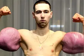 6个来自不同国家的奇怪健美运动员，疯狂注射药物结果害人害己！视频封面