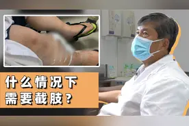 右腿肿大十余年，拍片后发现巨大肿瘤！患者：保肢还有希望吗？视频封面