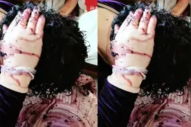 妈妈网上看到桑葚能染发一顿猛操作，家人哭笑不得：头皮都染紫了