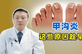 脚趾甲总往肉里“钻”，一碰还疼？甲沟炎的3个“祸根”终于找到视频封面