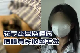 17岁花季少女染怪病，后腰竟长浓密毛发，这到底是什么怪病？视频封面