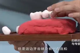 牙齿缺失选哪种修复方式？专家推荐这3种，您适合哪一种呢？视频封面