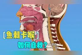 鱼刺卡喉是喝醋、吞饭还是塞大蒜？NO！专家教你三招科学自救妙招